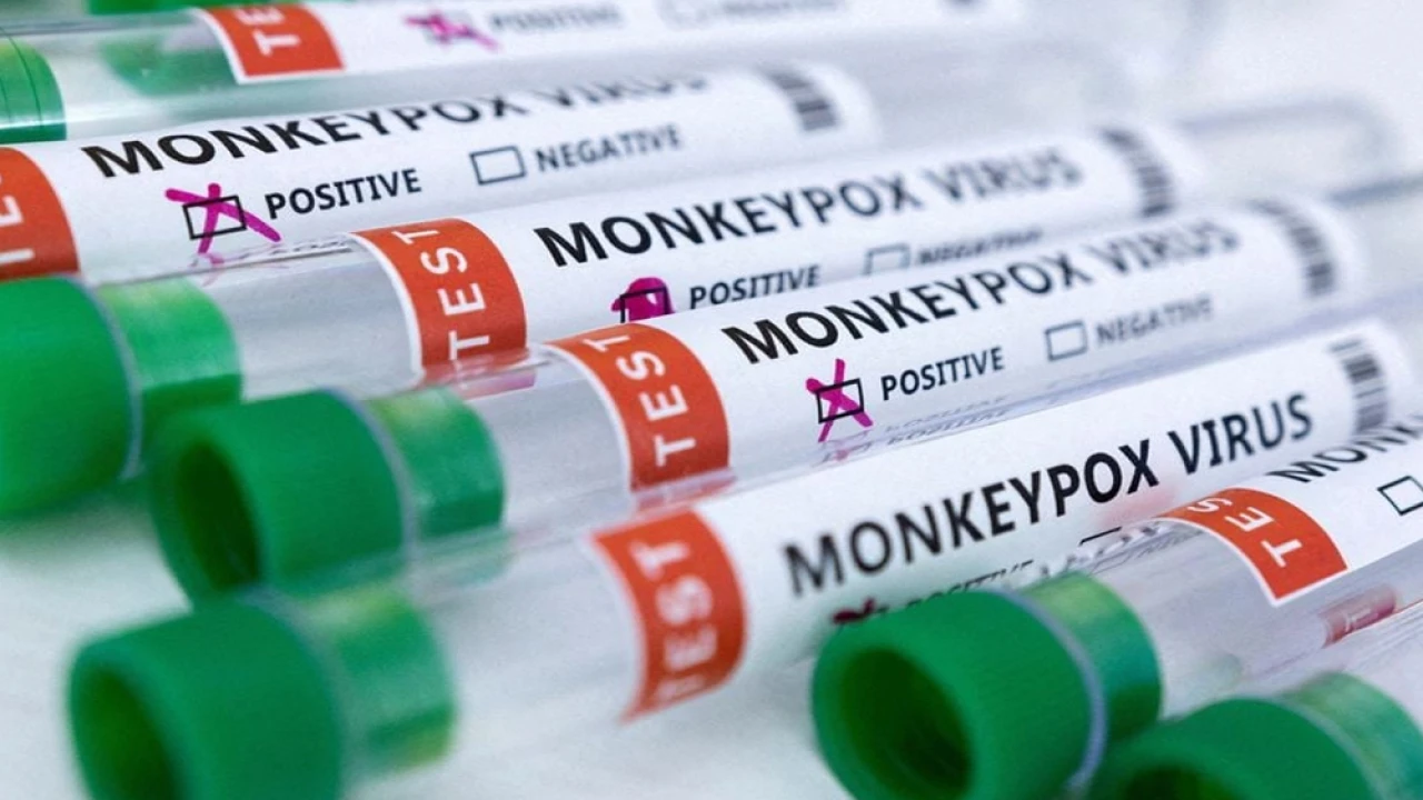 Spread of Monkeypox – A major threat for Pakistan